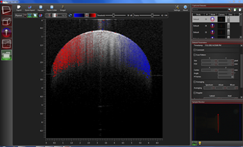 OCT Doppler Imaging Screen Shot