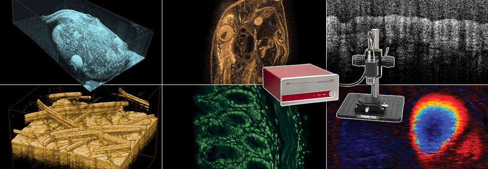 OCT Studies Cortical Microvasculature