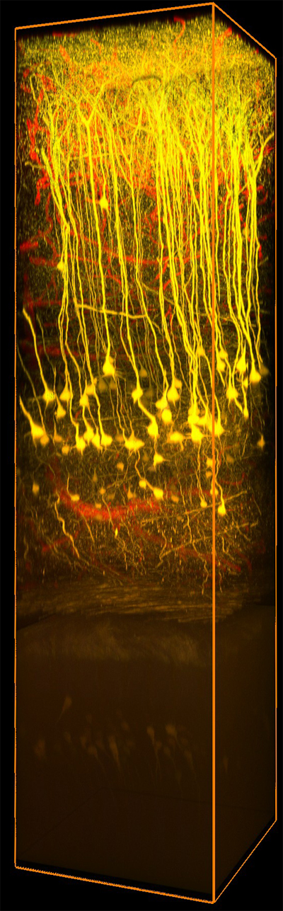 Deep Brain Image
