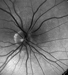 Opthalmology