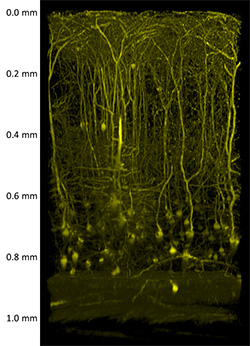 In-Vivo Deep Tissue Imaging