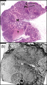 Figure 1.1