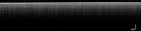 Image Field Correction