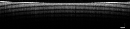 Image Field Correction