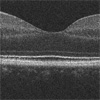 OCT image of human fovea