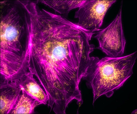 Image of bovine pulmonary artery endothelial (BPAE) cells acquired using a Cerna microscope.</br>(Courtesy of the Lab of Dr. Peter Stys, University of Calgary.)