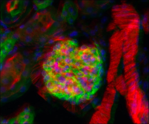 Epi-fluorescence of mouse kidney cells using a Cerna microscope.