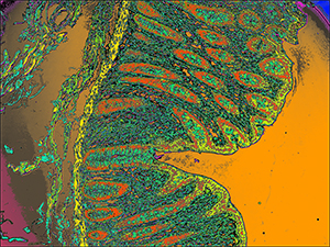 Hyperspectral Imaging Analysis