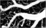 OCT Measures Capillary Blood Flow